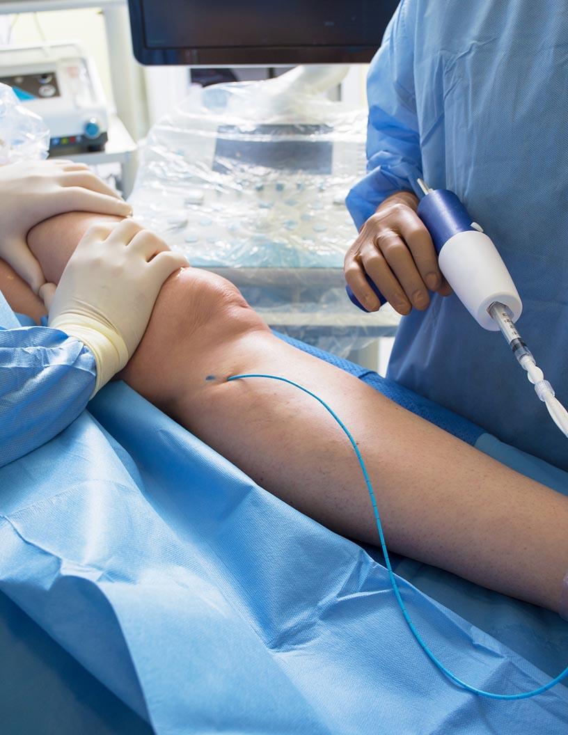 Peripheral Guidewires Market Analysis, Size, and Forecast 2025-2029: North America (US, Canada, and Mexico), Europe (France, Germany, and UK), APAC (China, India, and Japan), South America (Brazil), and Rest of World (ROW)