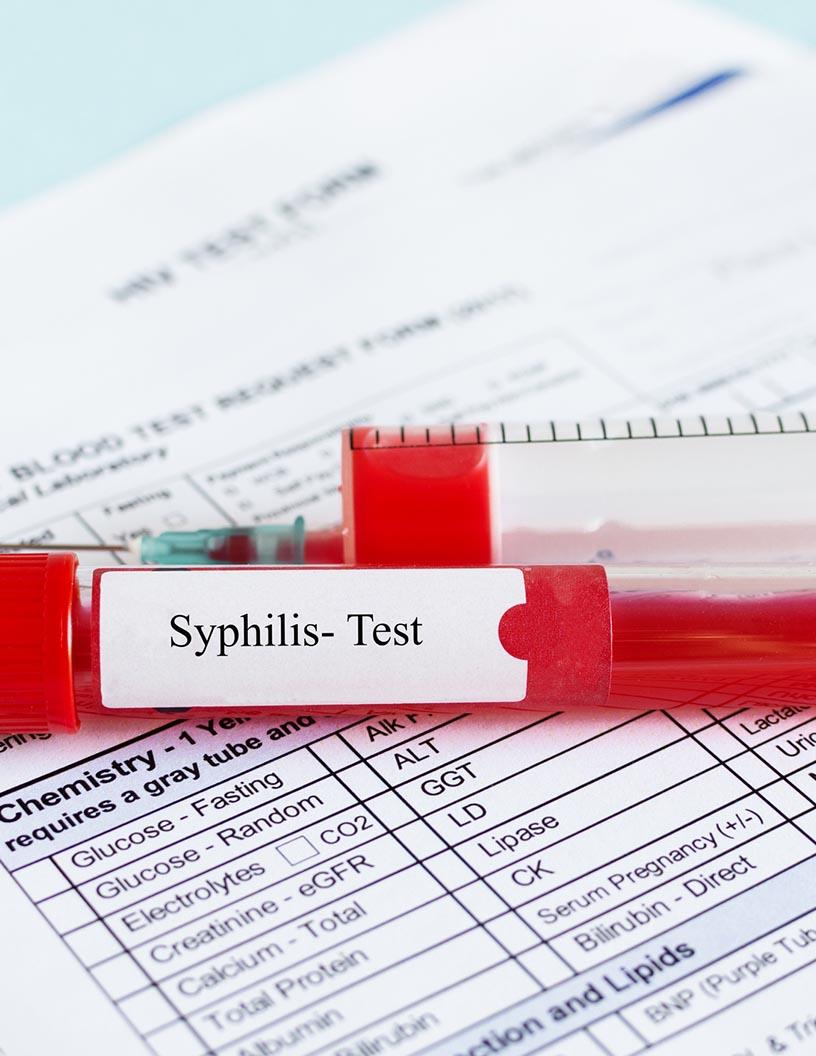 Syphilis Testing Market Analysis, Size, and Forecast 2025-2029: North America (US, Canada, and Mexico), Europe (France, Germany, Italy, and UK), APAC (China and Japan), South America (Brazil), and Rest of World (ROW)