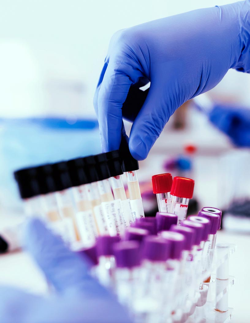 Electroporation Instruments Market by End-user and Geography - Forecast and Analysis 2021-2025