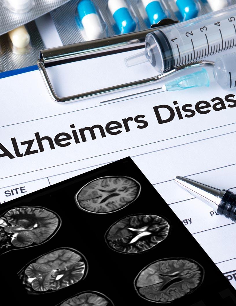 Alzheimers Disease Therapeutics Market Analysis, Size, and Forecast 2025-2029: North America (US, Canada, and Mexico), Europe (France, Germany, and UK), APAC (China, India, and Japan), South America (Brazil), and Rest of World (ROW)