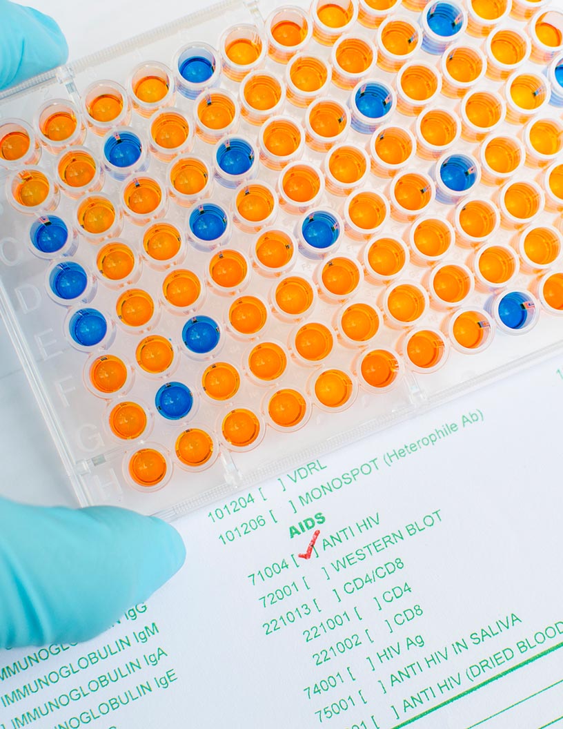 Enzyme-Linked Immunosorbent Assay (ELISA) Market Analysis North America, Europe, Asia, Rest of World (ROW) - US, UK, China, Germany, Japan - Size and Forecast 2024-2028
