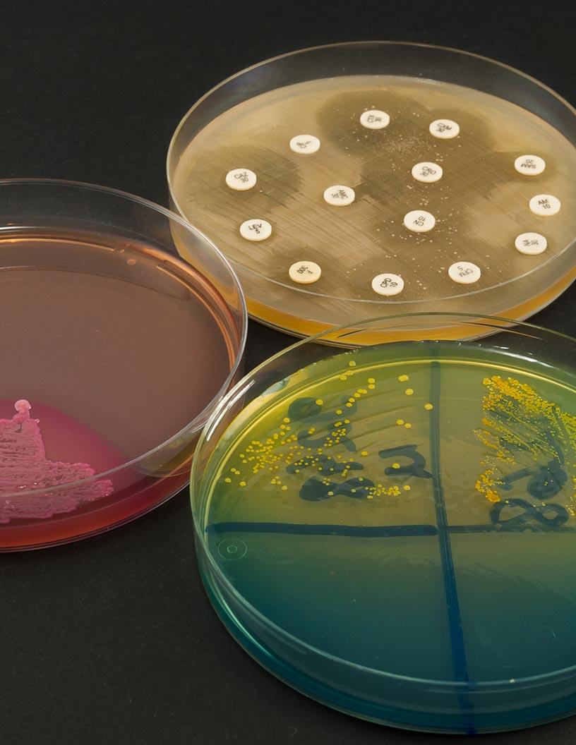 Microbiomes Market Analysis, Size, and Forecast 2025-2029: North America (US and Canada), Europe (France, Germany, UK), Asia (China, India, Japan, South Korea), and Rest of World (ROW) (Rest of World (ROW))