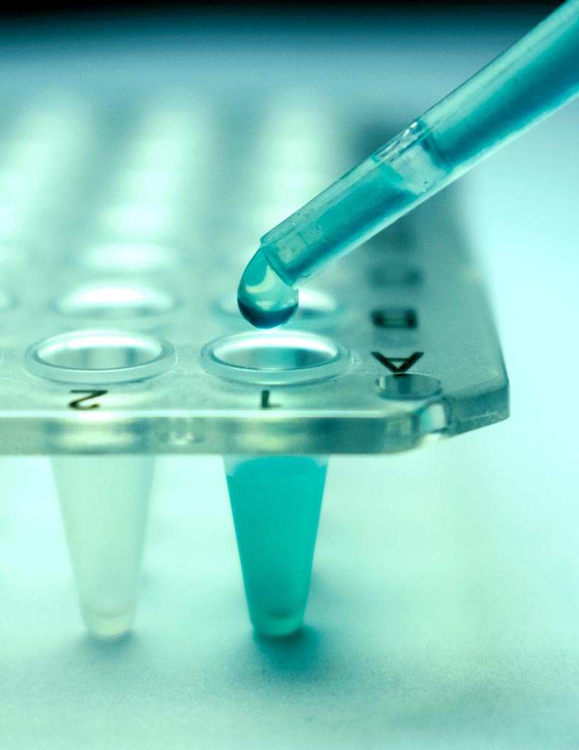 Autologous Cell Therapy Market by Product and Geography - Forecast and Analysis 2021-2025