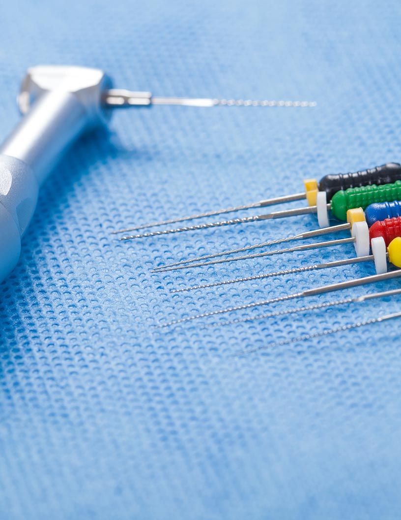 Endodontic Files Market by Product and Geography - Forecast and Analysis 2021-2025