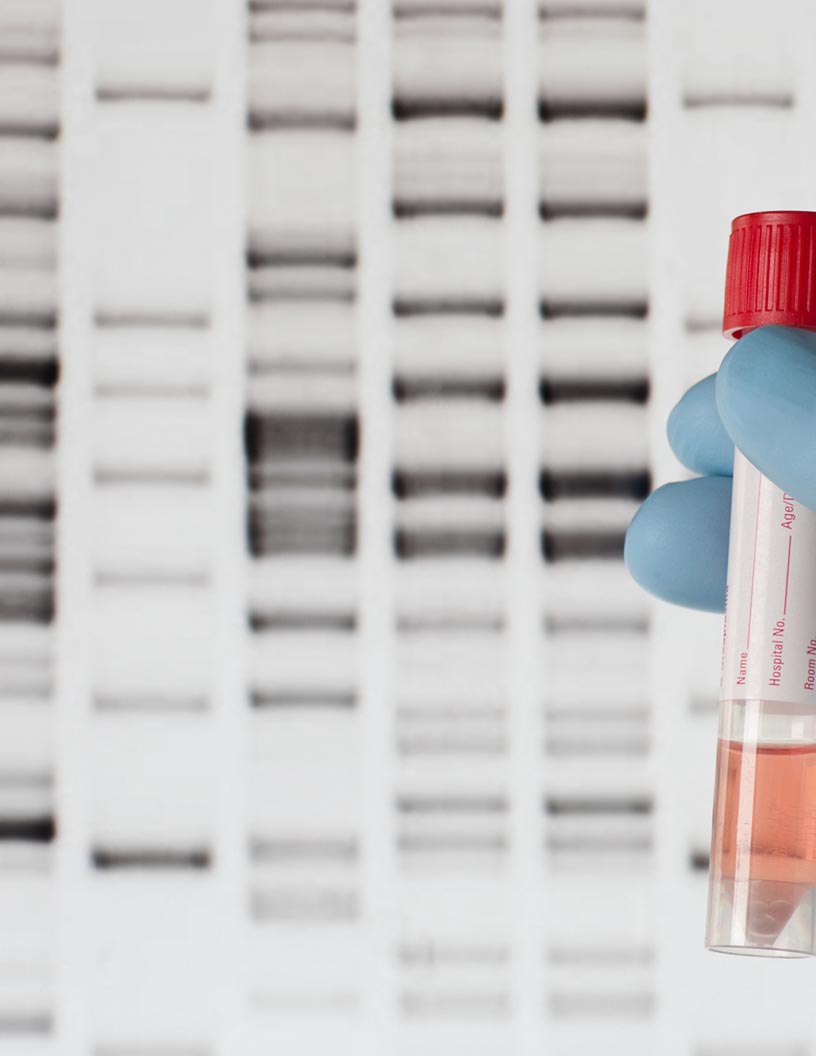 Biosimilar Monoclonal Antibodies (mAbs) Market by Application and Geography- Forecast and Analysis 2021-2025