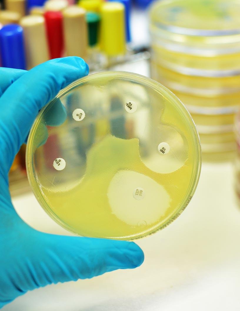 Antimicrobial Susceptibility Testing Market Analysis, Size, and Forecast 2025-2029: North America (US and Canada), Europe (France, Germany, Spain, UK), Middle East and Africa , APAC (China, India, Japan, South Korea), South America , and Rest of World (ROW)