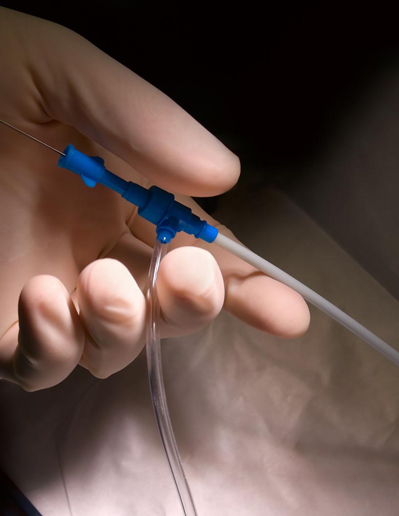 Cardiovascular Catheters Market Analysis Asia, North America, Europe, Rest of World (ROW) - India, China, Germany, UK, US - Size and Forecast 2024-2028
