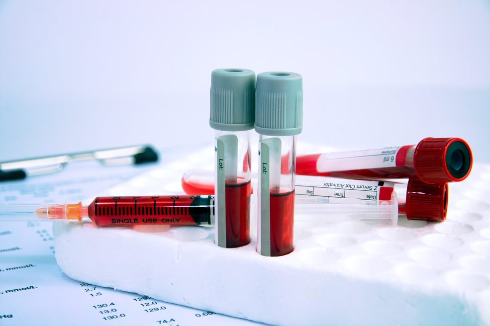 POC HbA1C Testing Market by Product and Geography - Forecast and Analysis 2020-2024