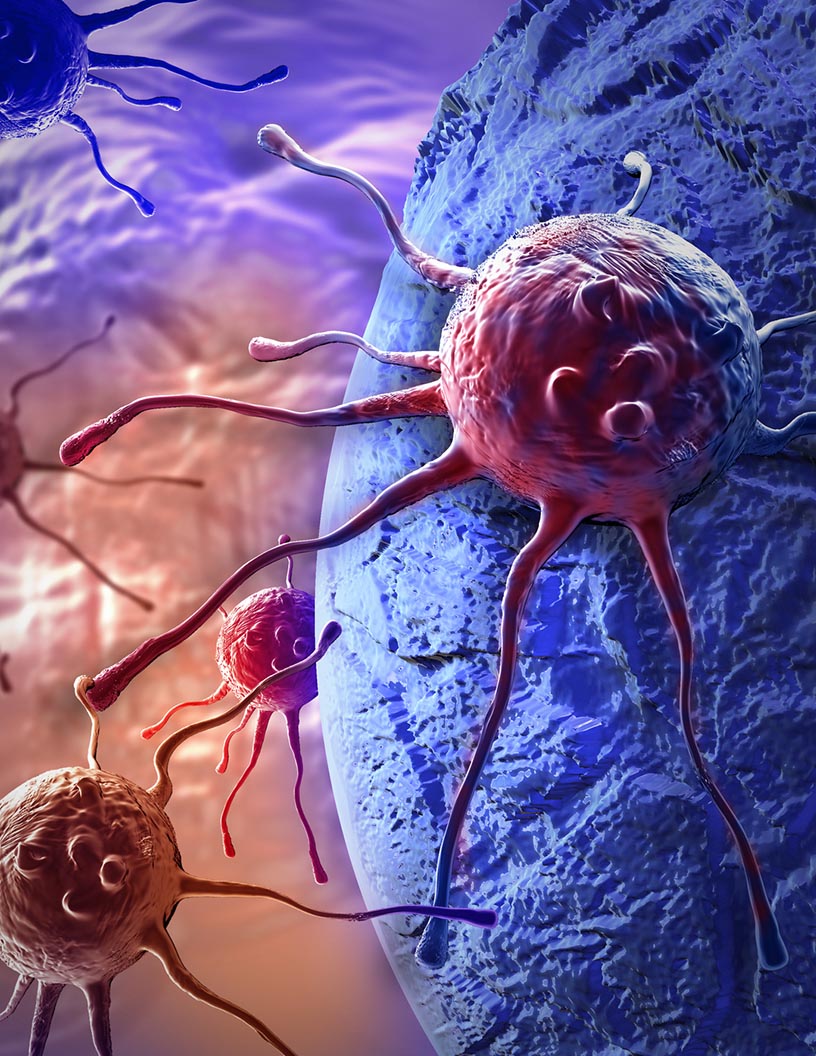 Brachytherapy Devices Market by Technique and Geography - Forecast and Analysis 2021-2025