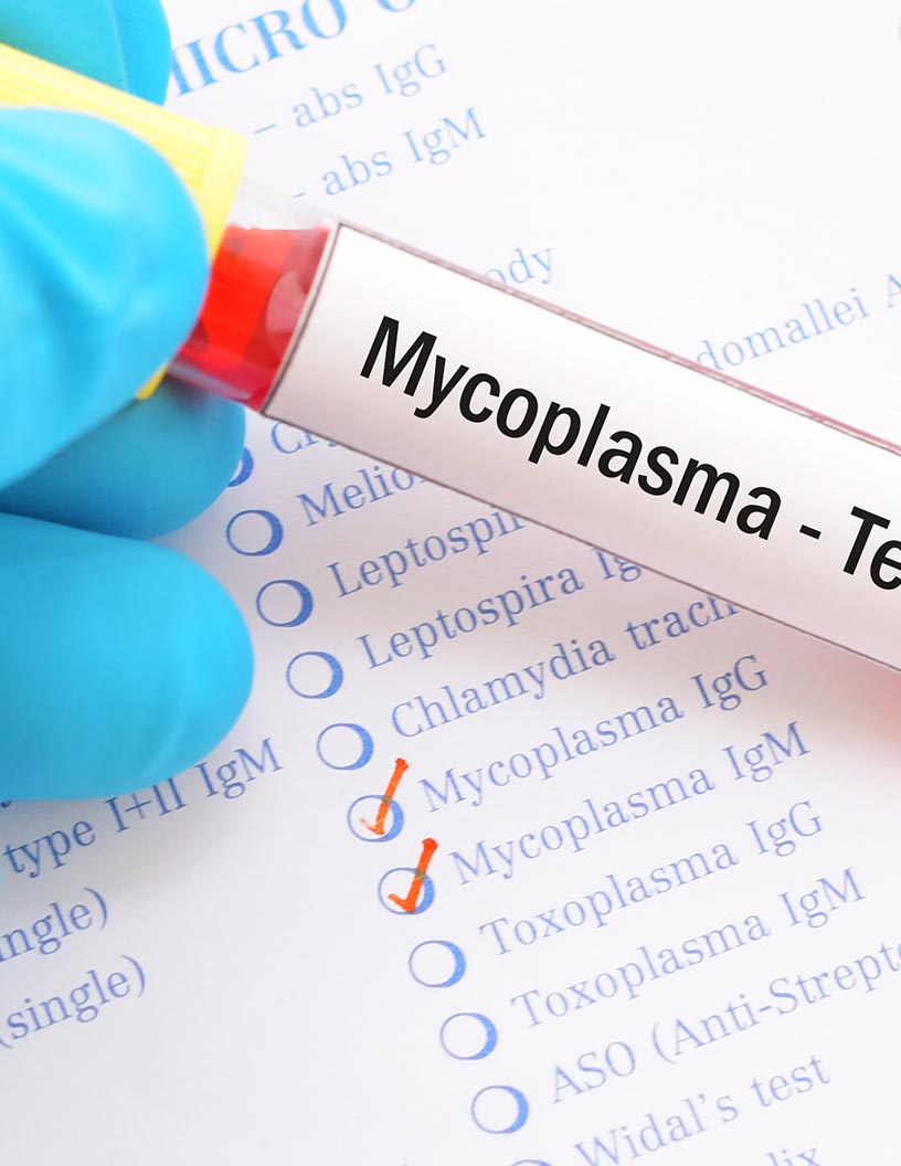 Mycoplasma Testing Market Analysis, Size, and Forecast 2024-2028: North America (US and Canada), Europe (France, Germany, Italy, and UK), Middle East and Africa (Egypt, KSA, Oman, and UAE), APAC (China, India, and Japan), South America (Argentina and Brazil), and Rest of World (ROW)