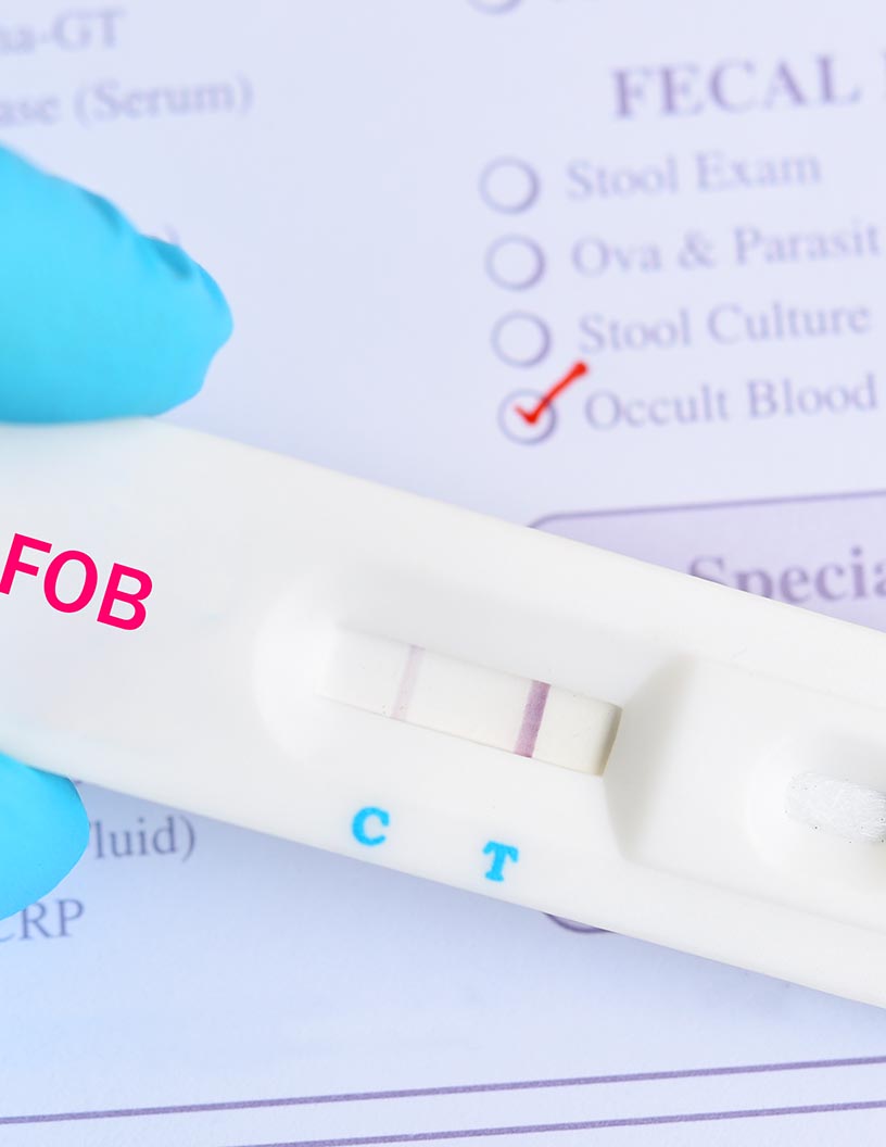 Fecal Occult Testing Market by End-user and Geography - Forecast and Analysis 2021-2025
