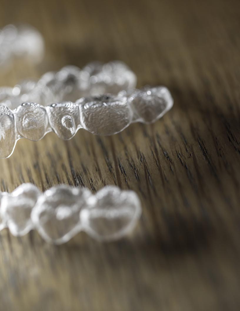 Invisible Orthodontics Market by Product and Geography - Forecast and Analysis 2021-2025