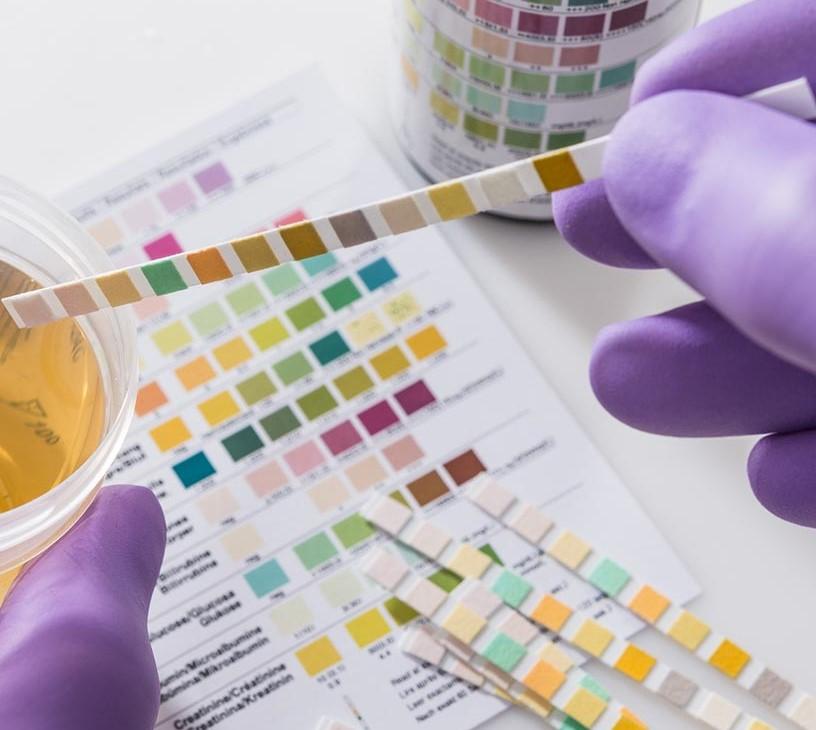 Urinalysis Market Analysis, Size, and Forecast 2025-2029: North America (US and Canada), Europe (France, Germany, Italy, and UK), APAC (China, India, and Japan), South America (Brazil), and Rest of World (ROW)