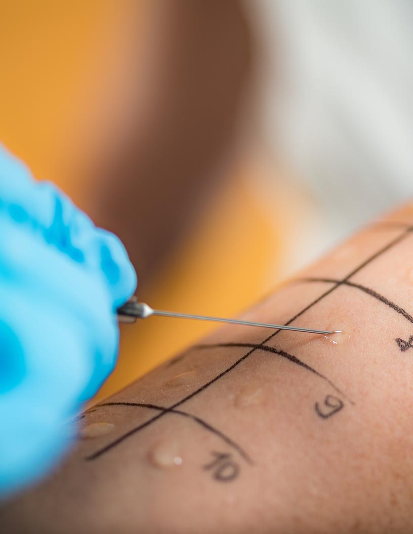 Allergy Diagnostics Market by Product, End-user, and Geography - Forecast and Analysis 2021-2025