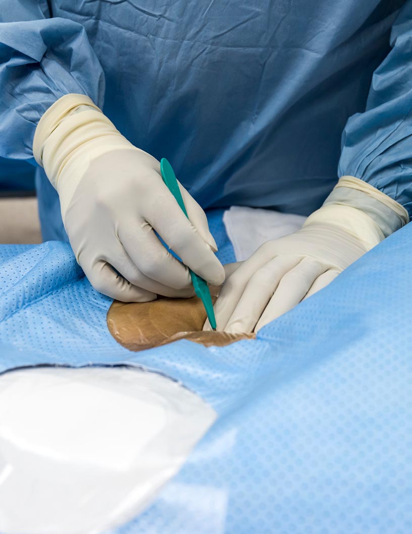 Surgical Drapes Market by Type and Geography - Forecast and Analysis 2021-2025