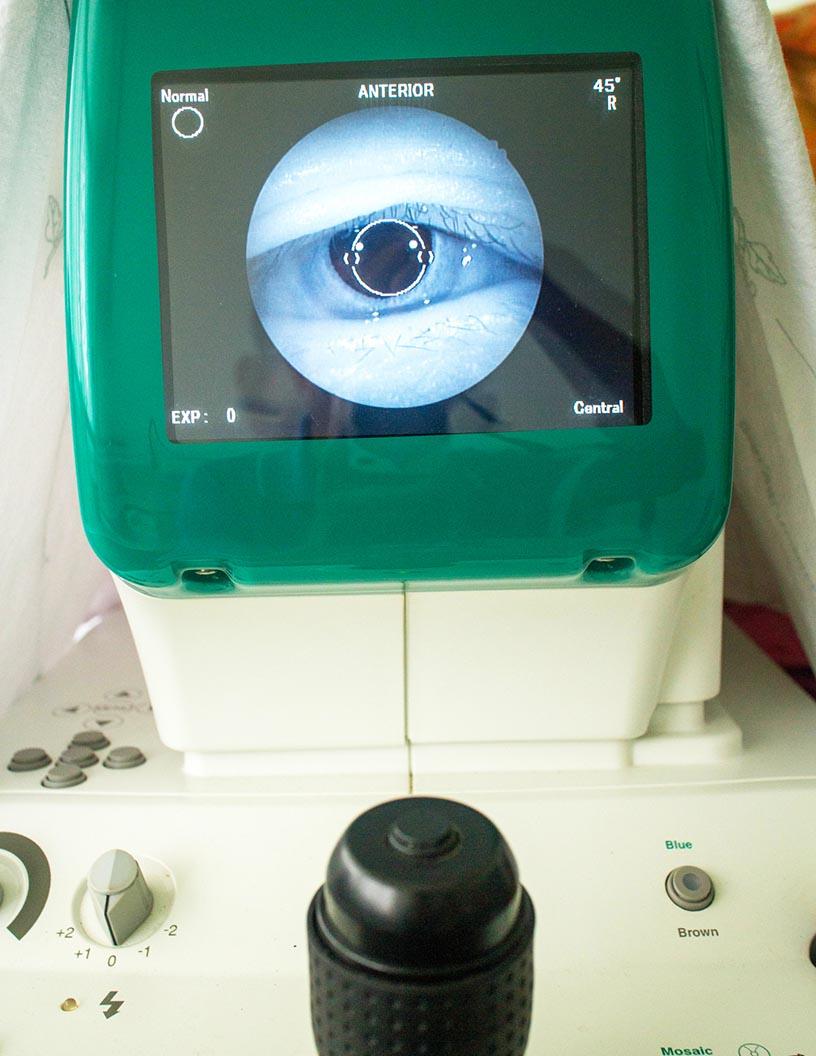 Fundus Camera Market Analysis North America, Europe, Asia, Rest of World (ROW) - US, Germany, Japan, China, UK, France, India, South Korea, Italy, Brazil - Size and Forecast 2025-2029