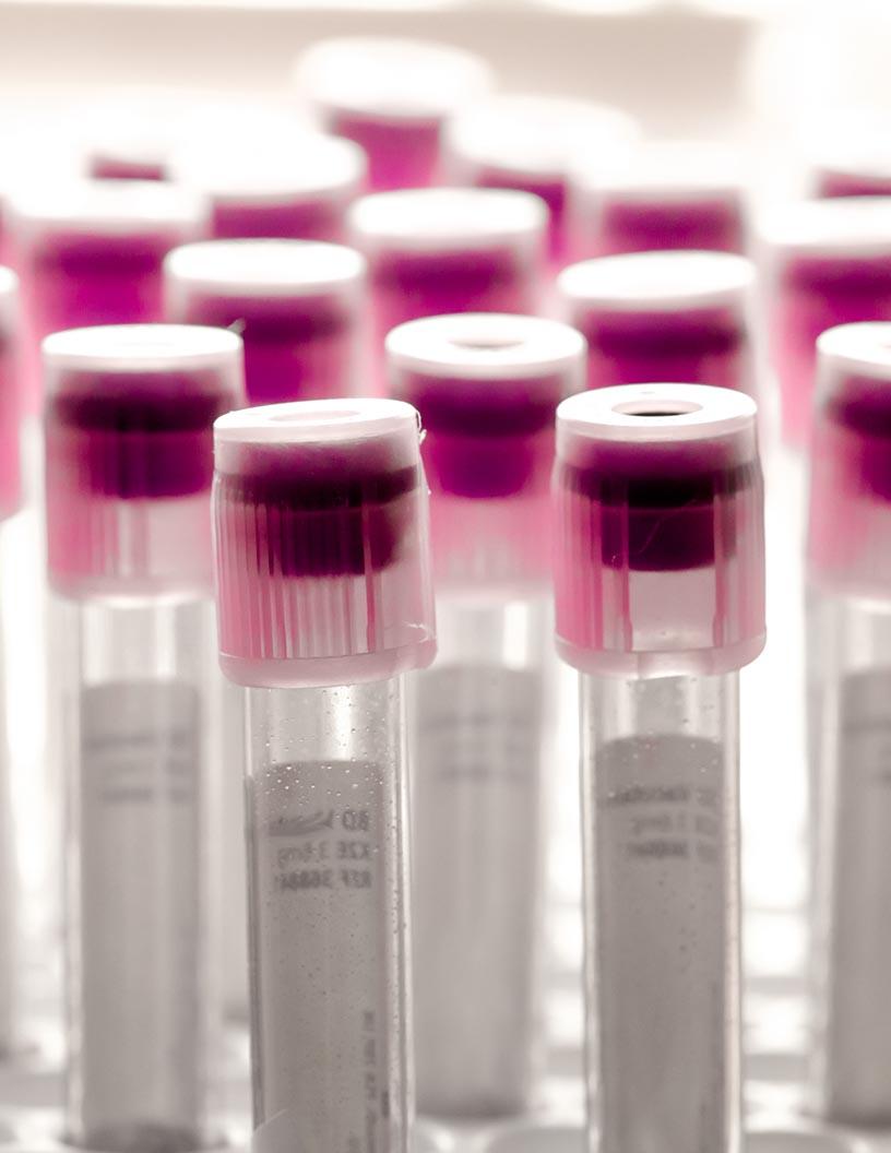 Industrial Enzymes Market Analysis, Size, and Forecast 2024-2028: North America (US, Canada), Europe (Germany, UK, Italy, France), APAC (China, India, Japan), South America (Brazil), Middle East & Africa