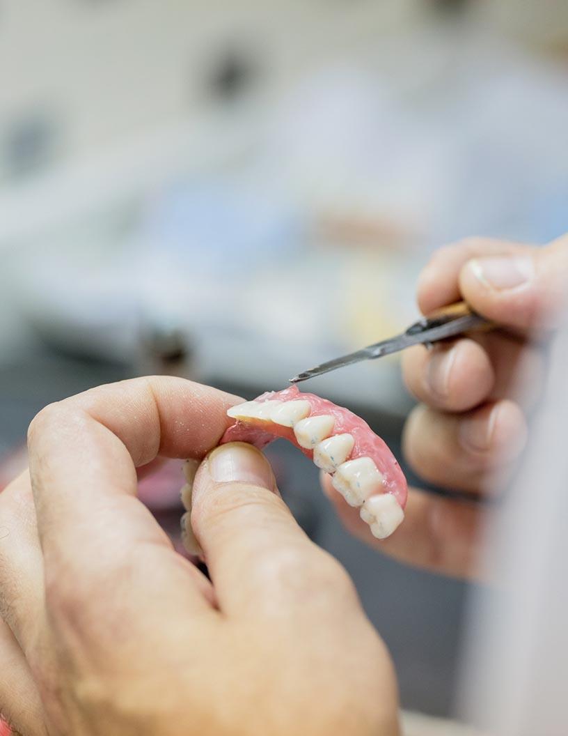 Dental Restoration Market Analysis, Size, and Forecast 2025-2029: North America (US, Canada, and Mexico), Europe (France, Germany, Italy, and UK), APAC (China, India, and Japan), and Rest of World (ROW)
