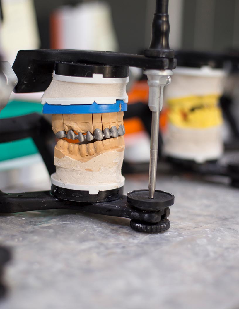 Endodontics Devices Market Analysis North America, Europe, Asia, Rest of World (ROW) - US, Germany, UK, China, Japan - Size and Forecast 2024-2028