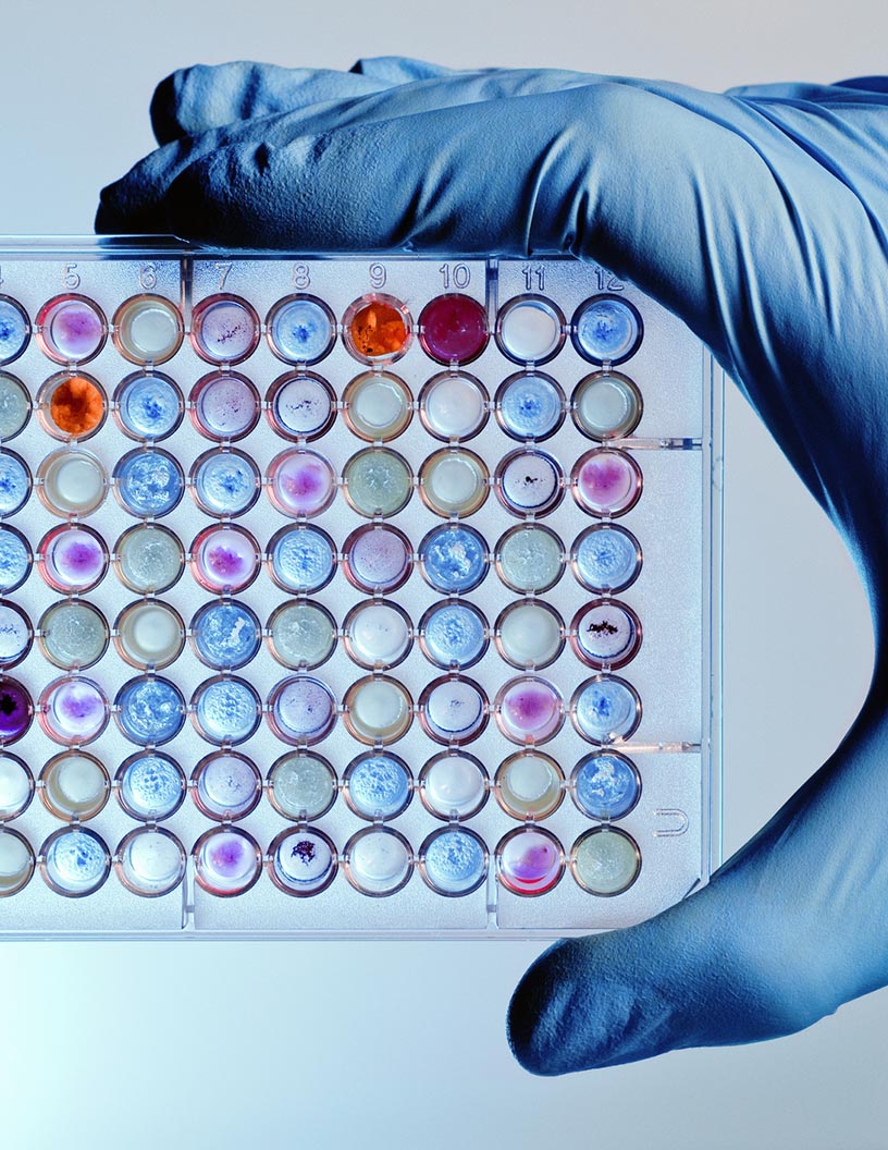 Molecular Microplate Readers and Washers Market Analysis North America, Europe, Asia, Rest of World (ROW) - US, Germany, UK, China, Japan - Size and Forecast 2024-2028
