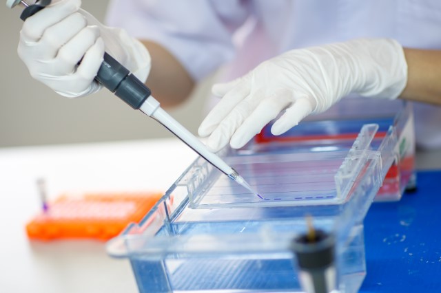 Gel Electrophoresis Market by Product, End-user, and Geography - Forecast and Analysis 2020-2024