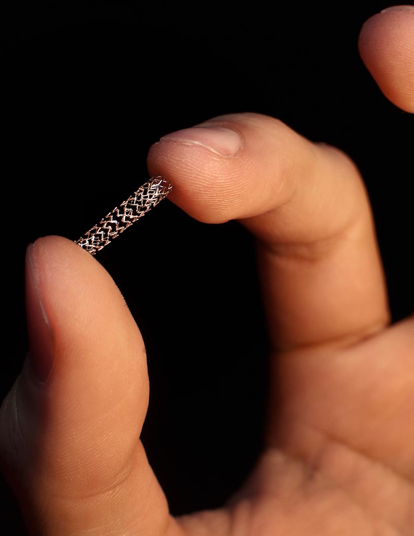 Bioabsorbable Stents Market by End-user and Geography - Forecast and Analysis 2021-2025