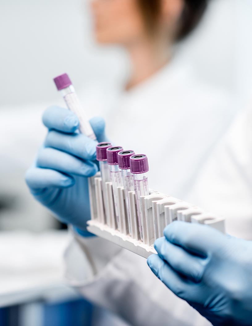 Protein Expression Market Analysis North America, Europe, Asia, Rest of World (ROW) - US, UK, China, Germany, Japan - Size and Forecast 2024-2028