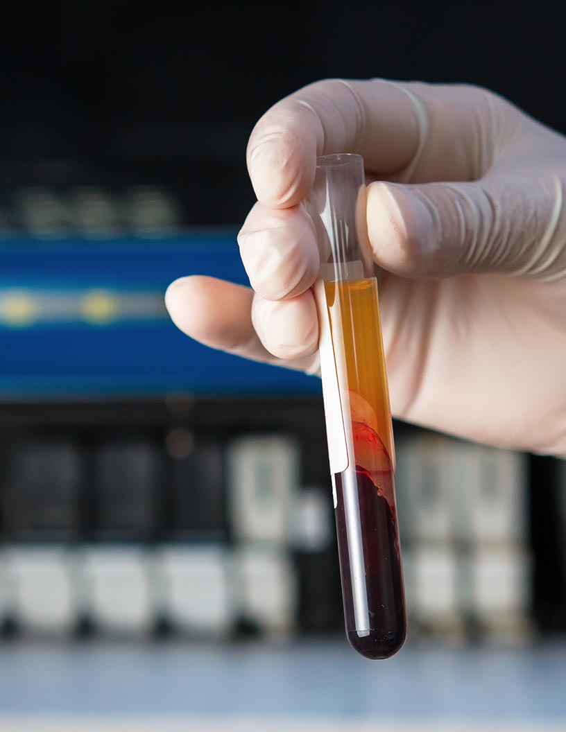 Coagulation Testing Market by Product, Application, Technology, End-user, and Geography - Forecast and Analysis 2021-2025