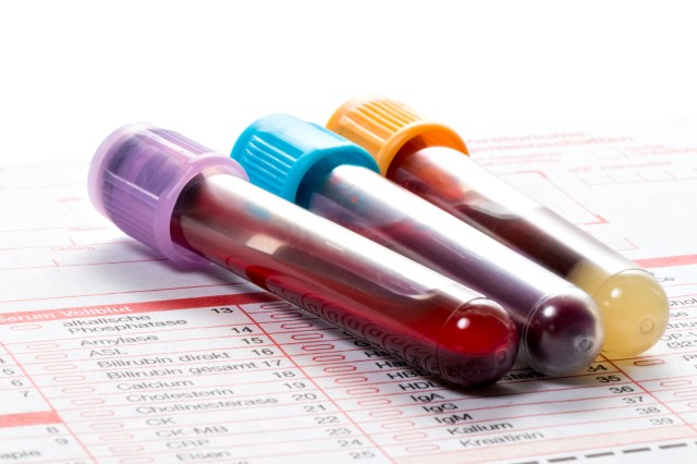 Hemoglobin Testing Market by Technology, Product, End-user, and Geography - Forecast and Analysis 2020-2024