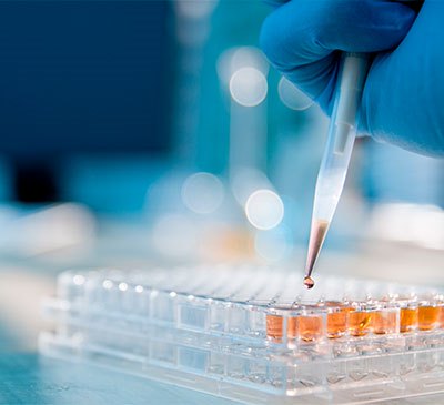 Sample Preparation Market by Product, End-user, and Geography - Forecast and Analysis 2020-2024