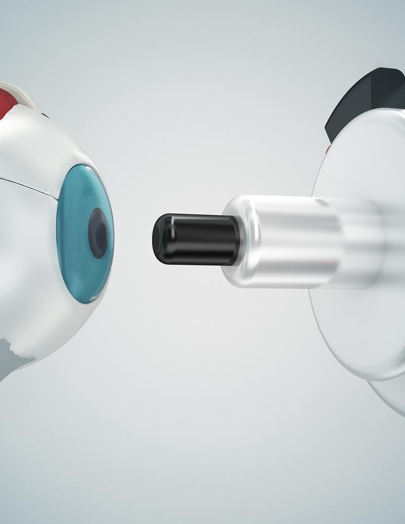 Ophthalmic Femtosecond Lasers Market Analysis, Size, and Forecast 2024-2028: North America (Mexico), Europe (France, Germany, Italy, Spain, and UK), Middle East and Africa (UAE), APAC (Australia, China, India, Japan, and South Korea), South America (Brazil), and Rest of World (ROW)