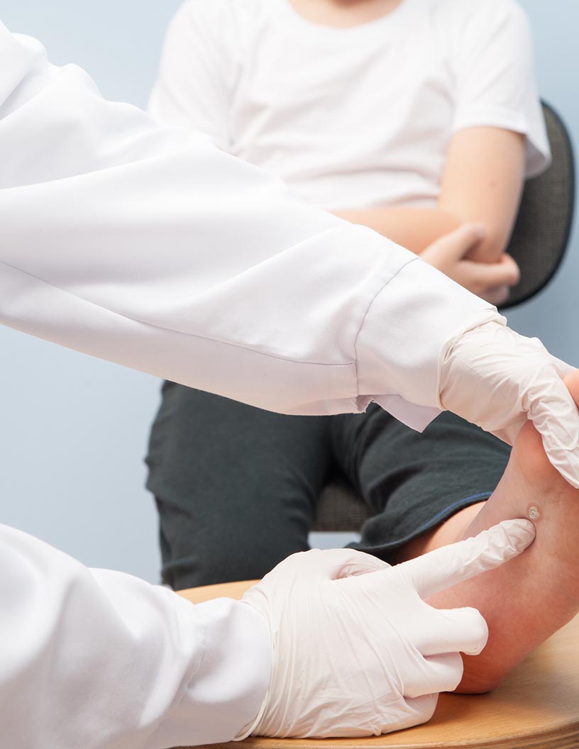 Diabetic Foot Ulcers Therapeutics Market by Product and Geography - Forecast and Analysis 2021-2025