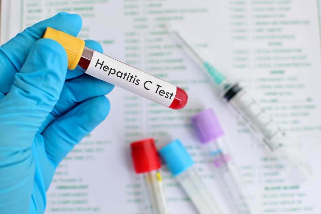 Hepatitis C Drugs Market by Product and Geography - Forecast and Analysis 2021-2025