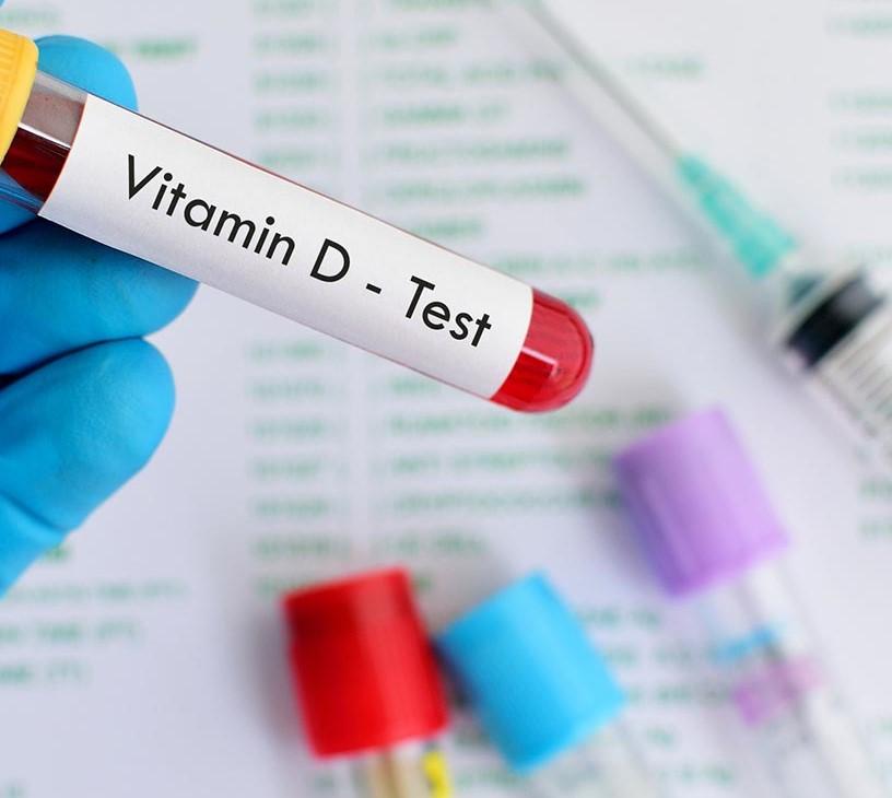 Vitamin D Testing Market Analysis, Size, and Forecast 2025-2029: North America (US, Canada, and Mexico), Europe (France, Germany, Italy, and UK), APAC (China, India, and Japan), and Rest of World (ROW)