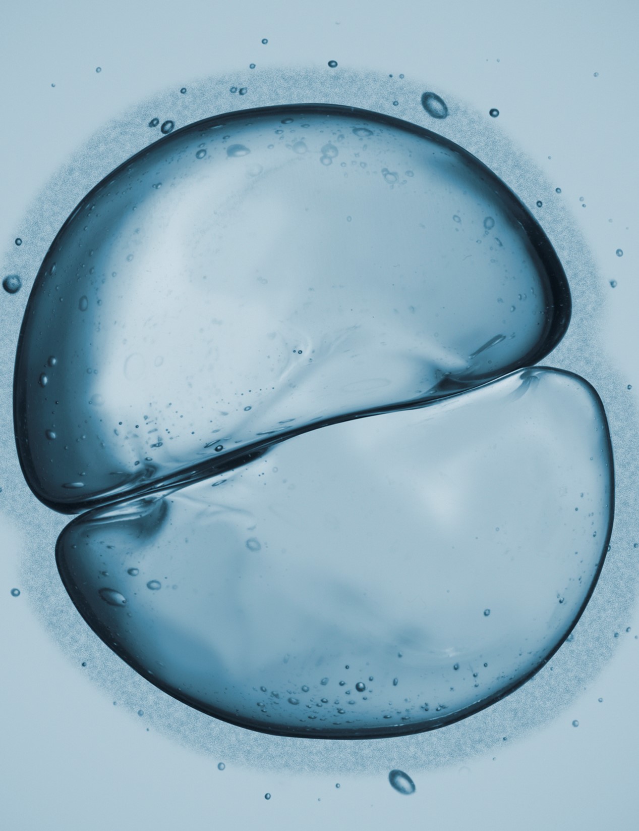 Cell Imagers Market by Product and Geography - Forecast and Analysis 2021-2025