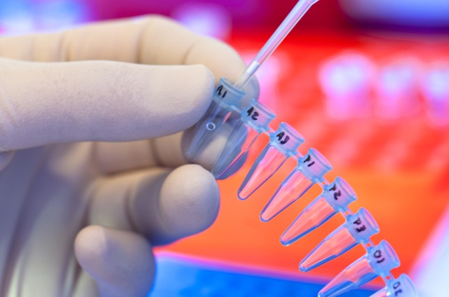 Antisense and RNAi Therapeutics Market by Type, Application, and Geography - Forecast and Analysis 2021-2025