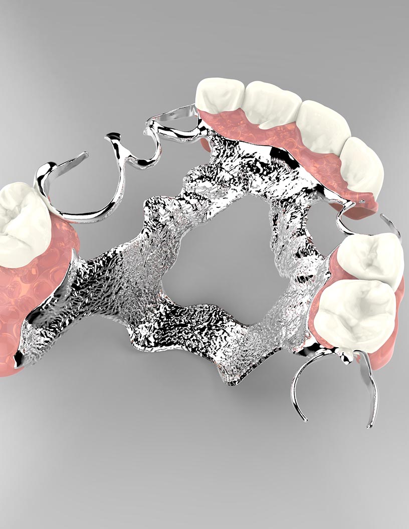 Dental Adhesives Market Analysis Europe, North America, Asia, Rest of World (ROW) - US, China, Germany, France, Canada - Size and Forecast 2024-2028