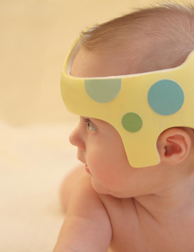 Cranial Orthoses Market Analysis, Size, and Forecast 2025-2029: North America (US and Canada), Europe (France, Germany, Italy, and UK), APAC (China, India, Japan, and South Korea), and Rest of World (ROW)