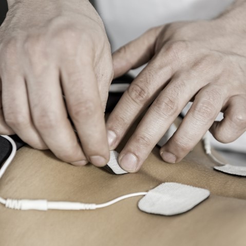 Peripheral Nerve Stimulators Market by Product, Stimulating Feature, and Geography - Forecast and Analysis 2021-2025