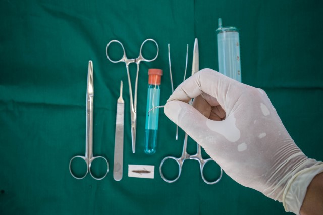 Suture Anchor Market by Type, Material, and Geography - Forecast and Analysis 2021-2025