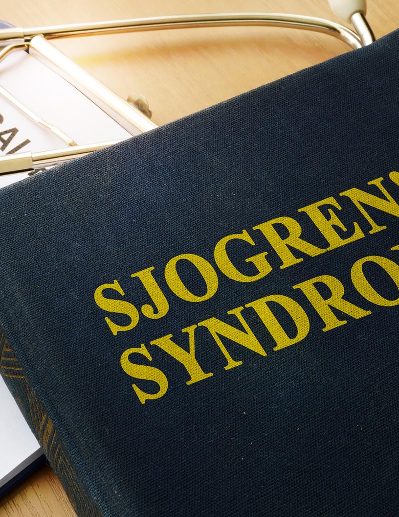 Sjogrens Syndrome Therapeutics Market Analysis North America, Europe, Asia, Rest of World (ROW) - US, Germany, China, Japan, UK - Size and Forecast 2024-2028