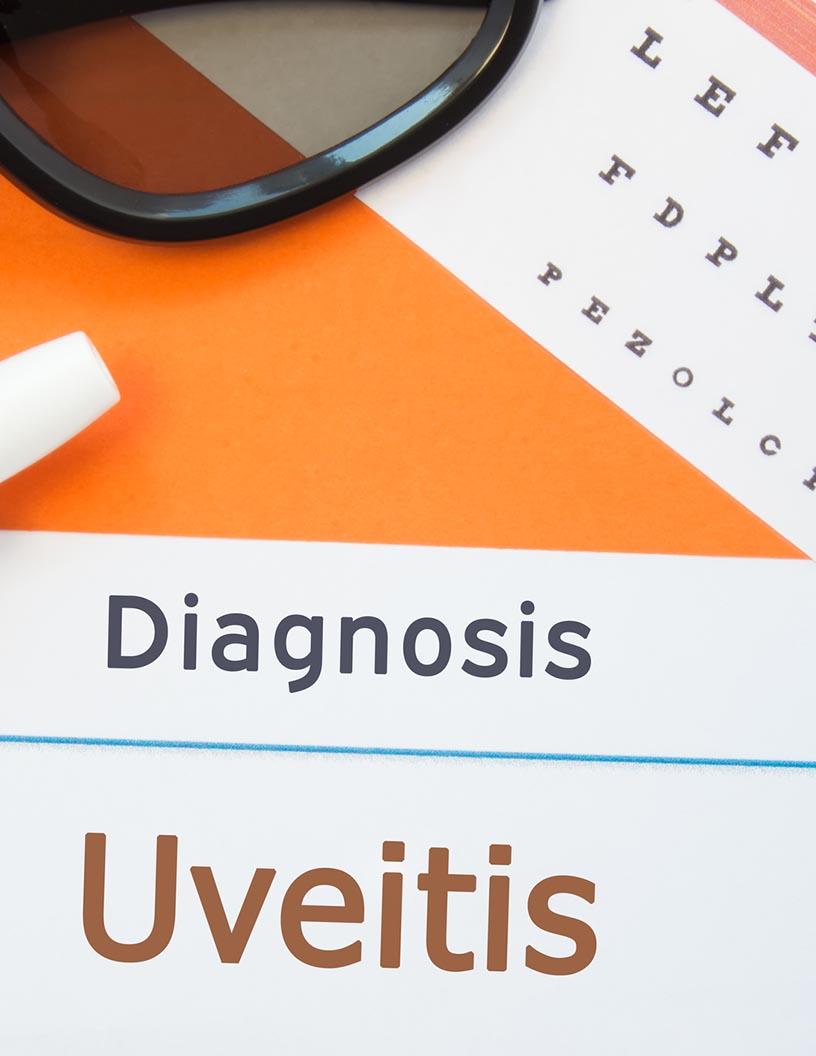 Uveitis Drugs Market Analysis North America, Europe, Asia, Rest of World (ROW) - US, Germany, UK, Canada, China - Size and Forecast 2024-2028