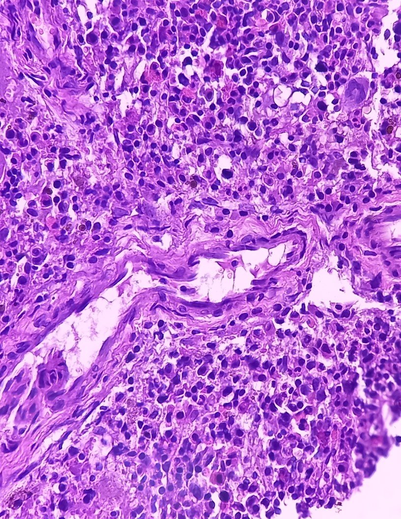 Non-Hodgkin Lymphoma (NHL) Therapeutics Market Analysis North America, Europe, Asia, Rest of World (ROW) - US, UK, Germany, China, Canada - Size and Forecast 2024-2028