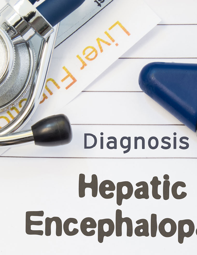 Hepatic Encephalopathy (HE) Therapeutics Market by Product and Geography - Forecast and Analysis 2021-2025