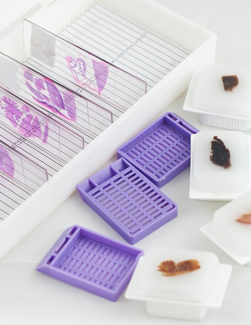 Histology and Cytology Market by Application and Geography - Forecast and Analysis 2021-2025