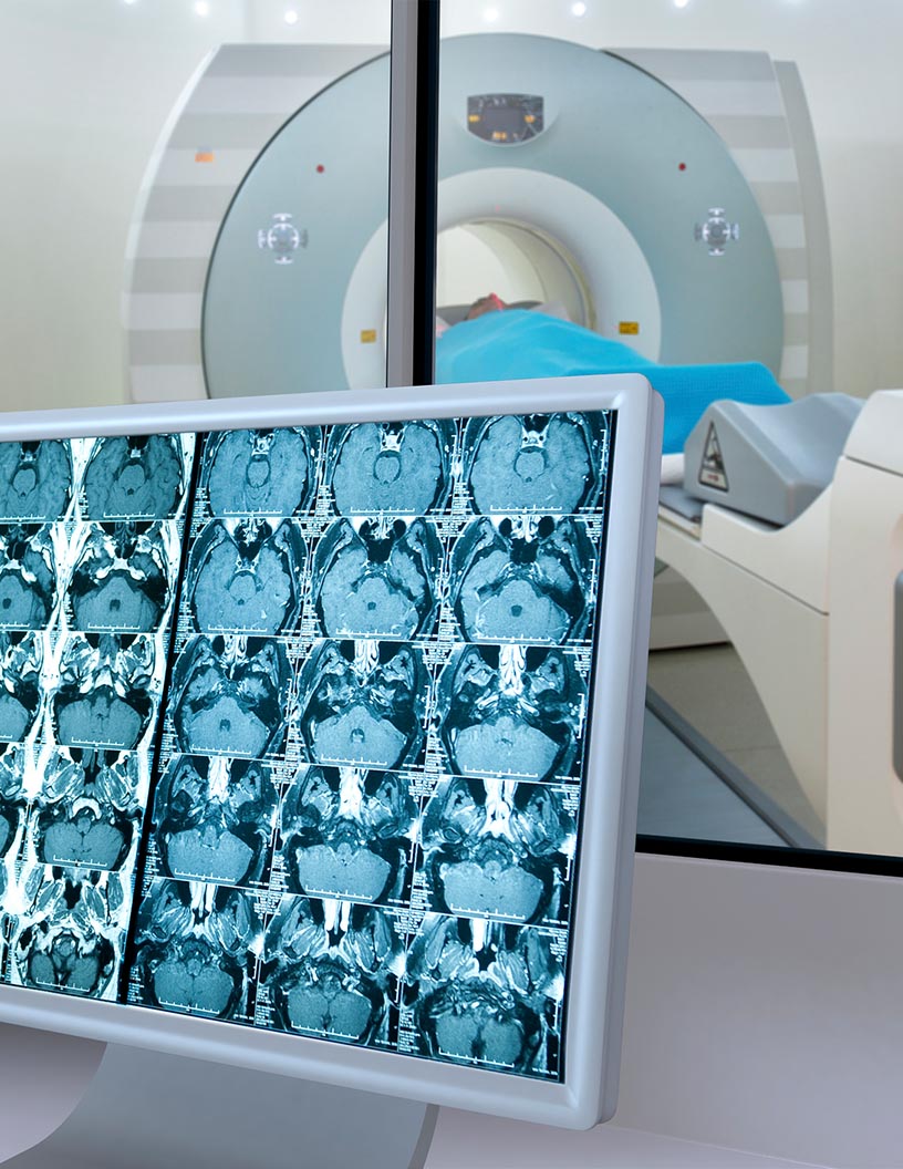 Oncology Clinical Trial Market by Design and Geography - Forecast and Analysis 2021-2025