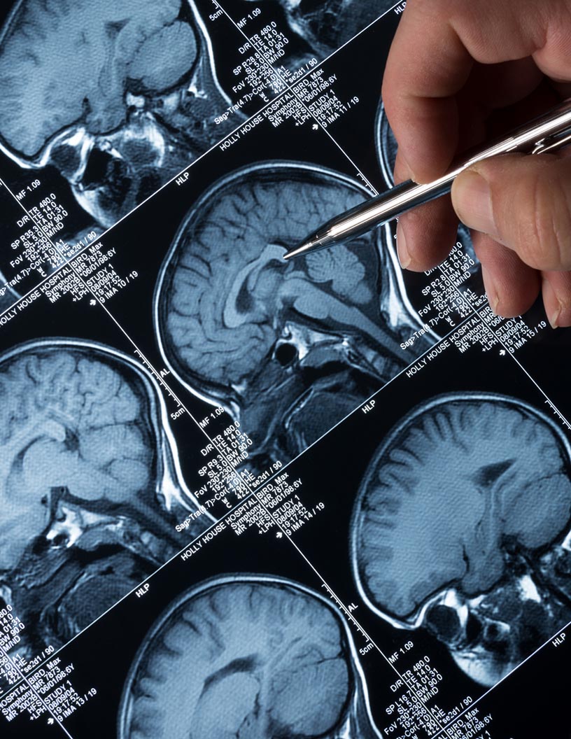 Diagnostic Imaging Market - North America, Europe, EMEA, APAC : US, Canada, China, Germany, UK - Forecast 2023-2027