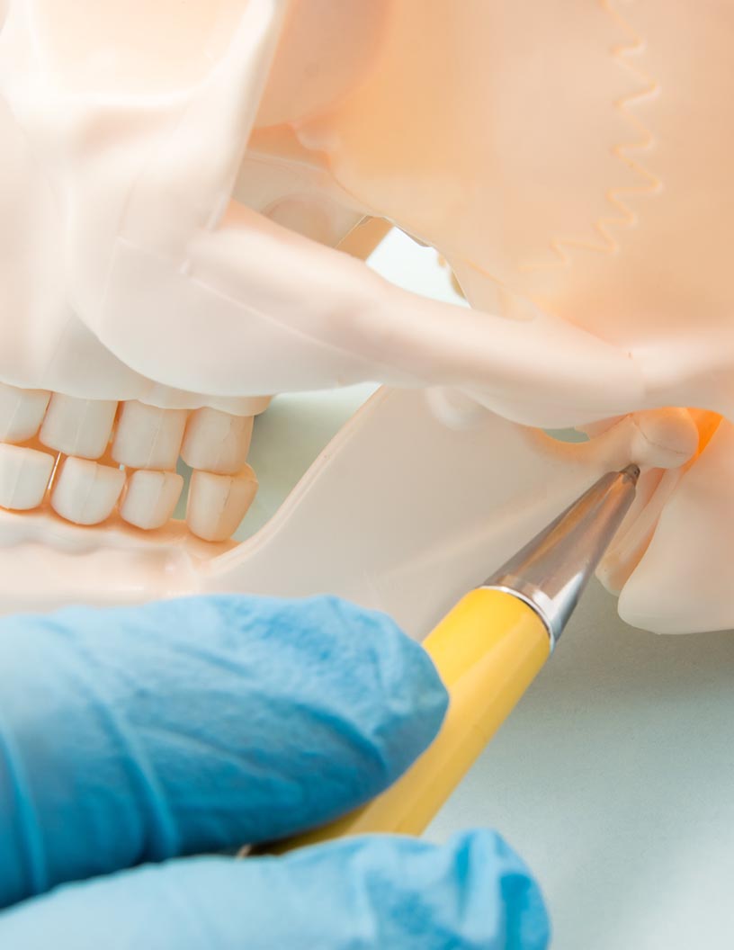 Craniomaxillofacial Devices Market by Product, End-user, and Geography - Forecast and Analysis 2021-2025