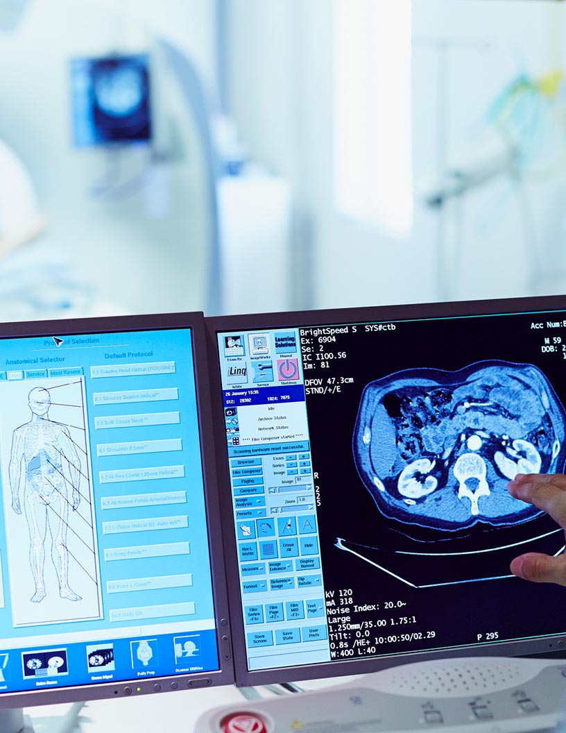 Hemodynamic Monitoring Market by Product and Geography - Forecast and Analysis 2021-2025