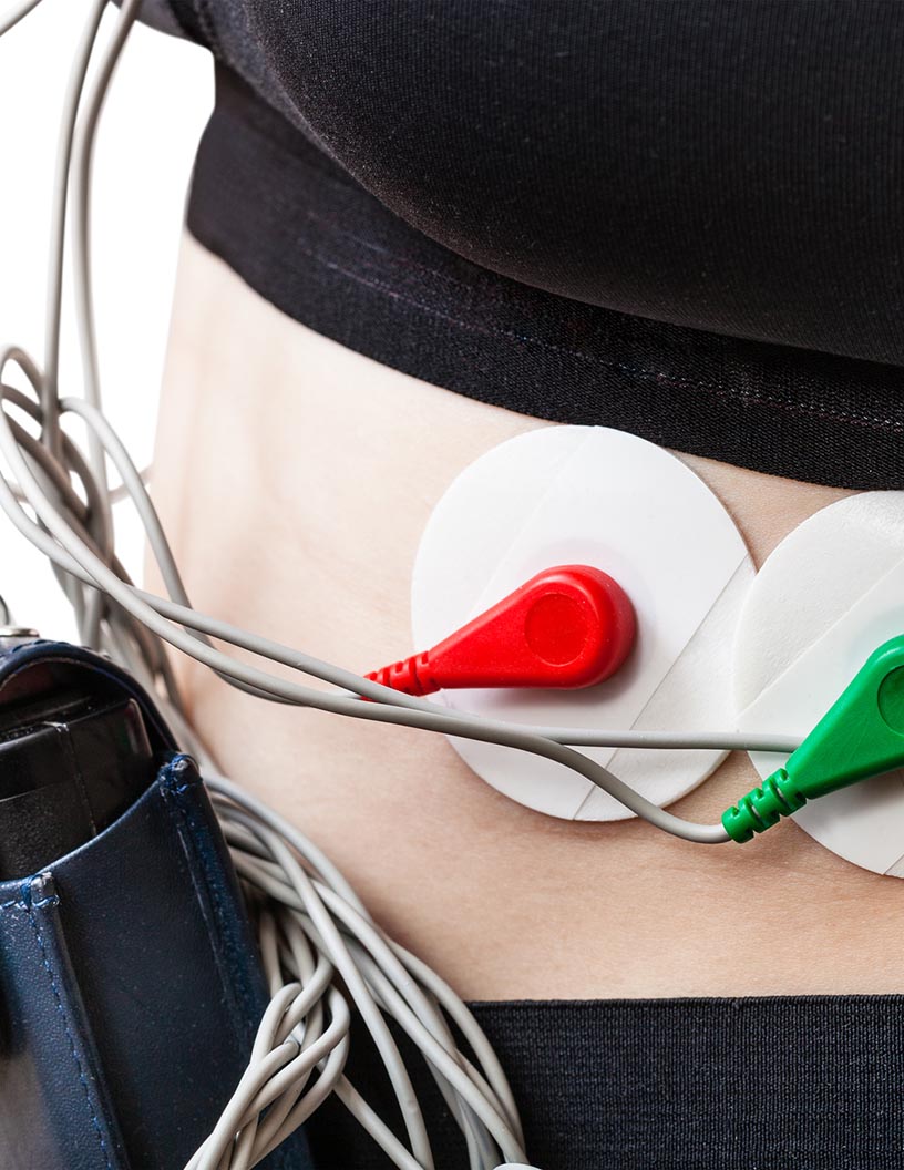 Mobile Cardiac Telemetry Systems Market by Technology and Geography - Forecast and Analysis 2021-2025